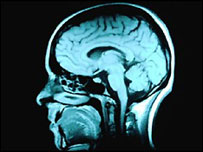 Image of brain